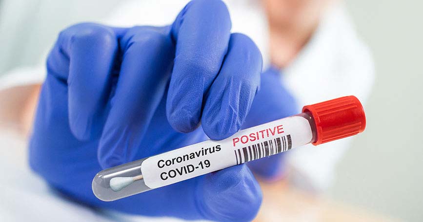 12 nuevos casos de coronavirus en VGG y 1 en Pueblo Esther