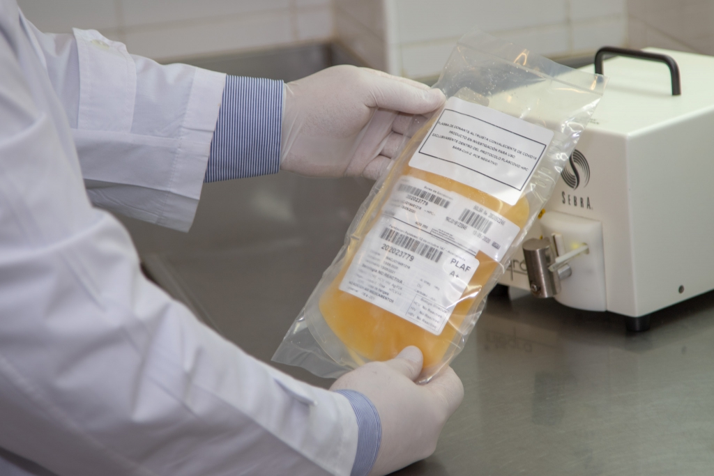 Evaluación de los primeros 4 meses de tratamientos con Plasma