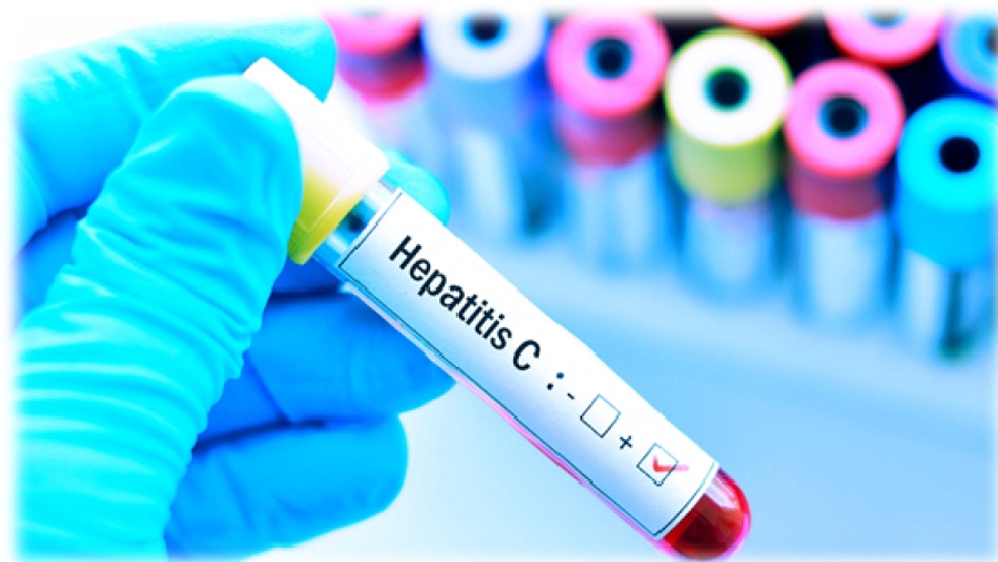 Hay 8 casos de hepatitis infantil de origen desconocido