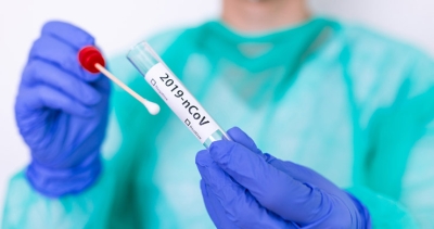 111 muertos y 11.443 nuevos casos de coronavirus en la última semana