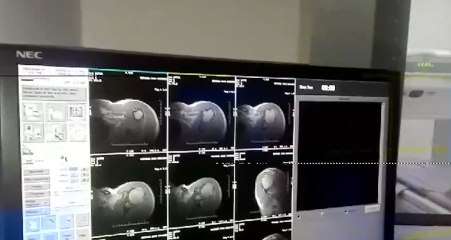Inauguran el primer resonador magnético en Villa Gobernador Gálvez
