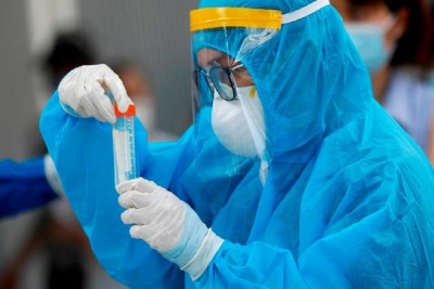 Especialistas estudian la variante "Mu" de Coronavirus